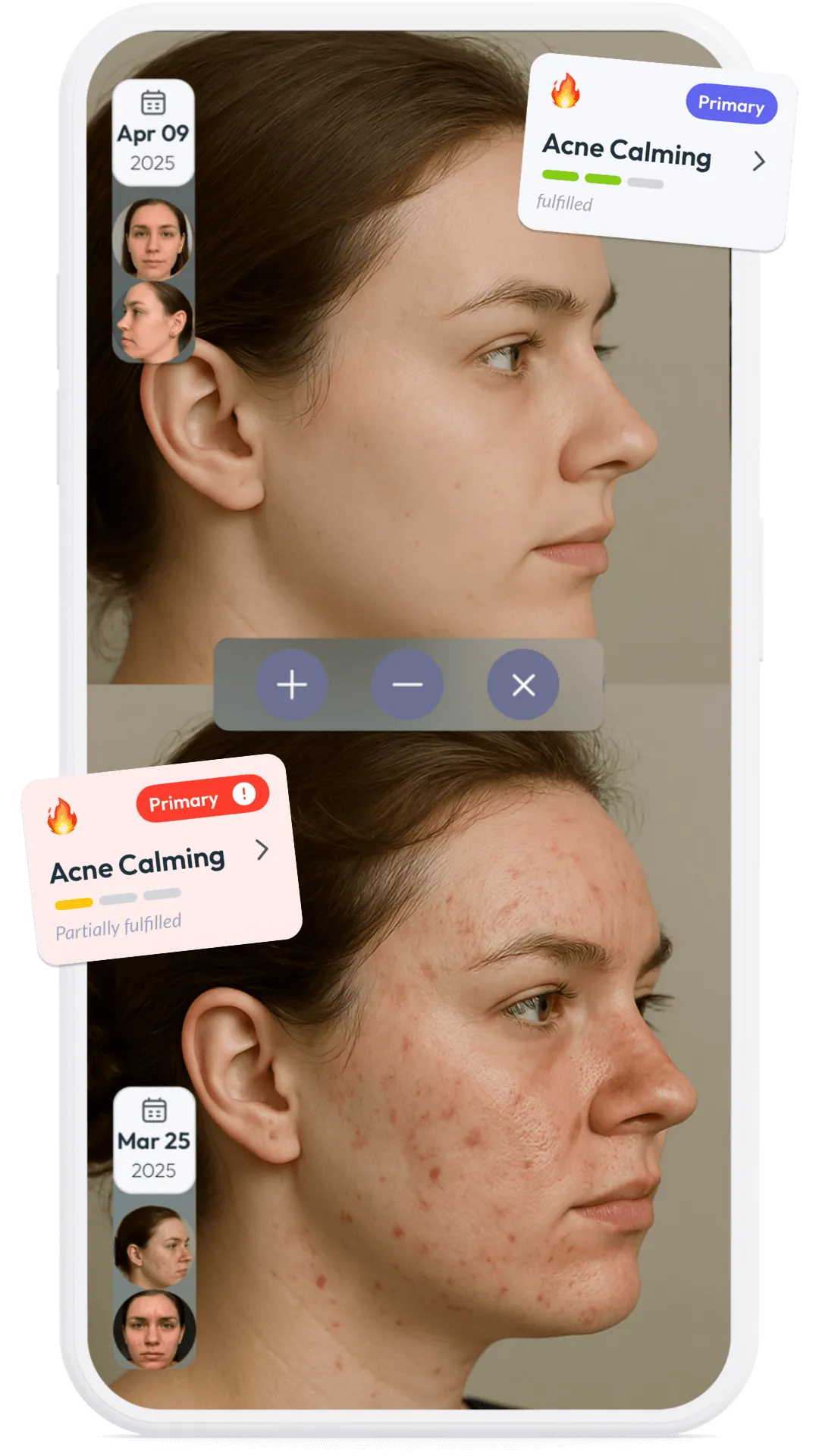 Skin Bliss photo comparison
